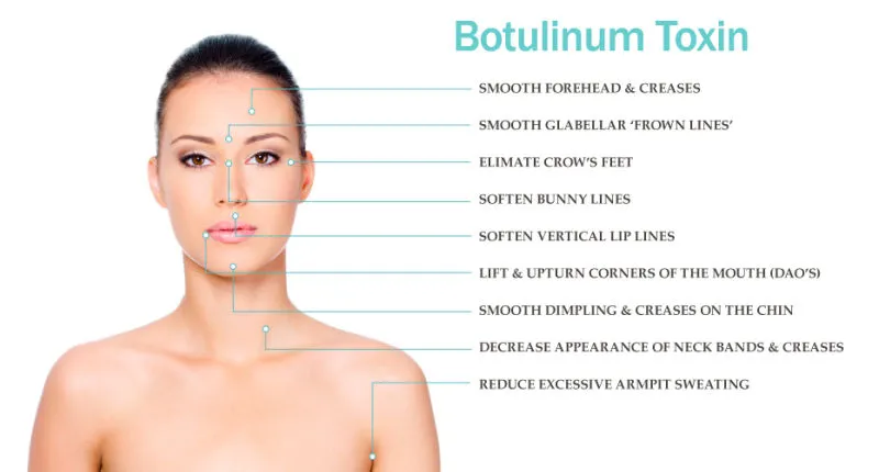 การลดความอ้วน Anti รอย Beutox Batulaxs รีสตี้ Dermal Filler Juvederms 0